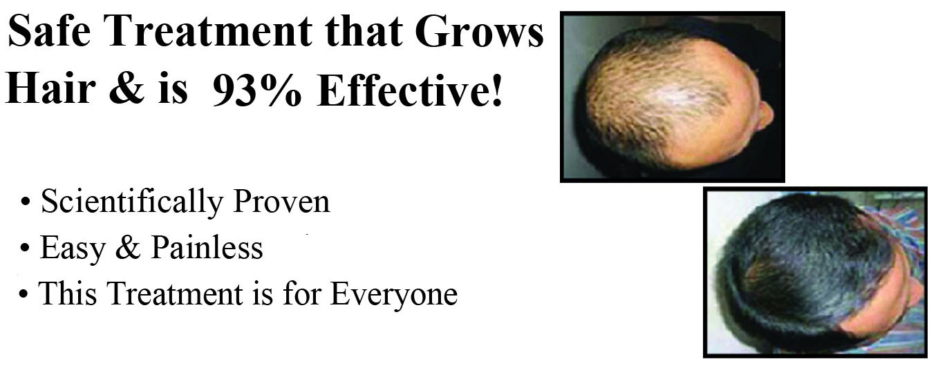 Hair Regrowth Treatments at The Payne Center Hair Regrowth Treatments at The Payne Center of Washington